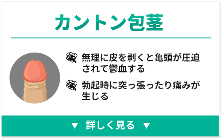 嵌頓包茎はどうすれば予防できるのでしょうか?
